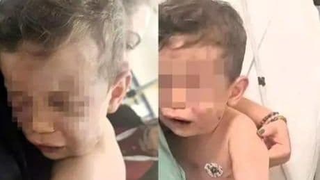 Caniler gözaltında! Devlet korumasına alınan 2 yaşındaki Aren bebek ameliyat edilecek