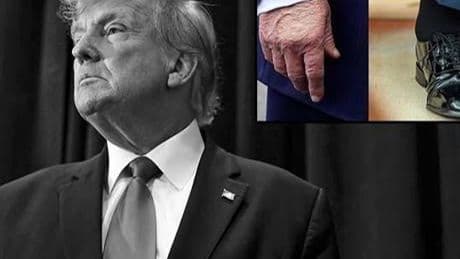 GÜNLERDİR KONUŞULUYORDU: ABD BAŞKANI TRUMP'IN GİZEMLİ HASTALIĞI ORTAYA ÇIKTI!