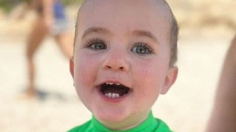 Tot diagnosed with cancer after parents spotted strange 'white glow' in one eye