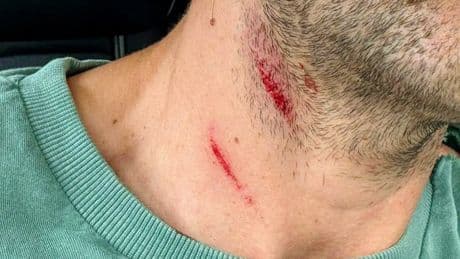 Detenida una mujer en Zaragoza acusada de robar a ancianos y agresión sexual