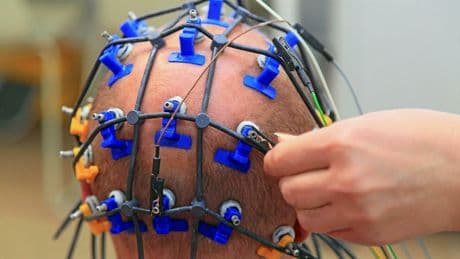 Parkinson, Alzheimer... Ce « casque » à ultrasons porteur d'espoir