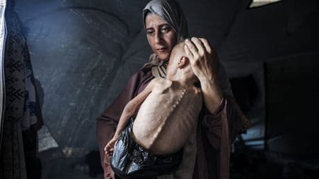 Hungersnot in Gaza - Wie dieses Kind für Propaganda missbraucht wird