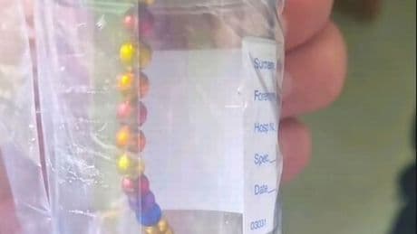 Terrifying magnet trend sweeping across Britain leaves hundreds of children hospitalised