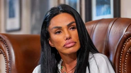 Katie Price (47) na zoveelste cosmetische ingreep: ’Ik kan niet meer lachen’