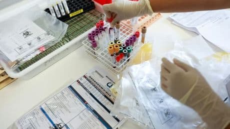 Chikungunya: le virus circule toujours activement à Mayotte, 969 cas confirmés depuis le début de l'année