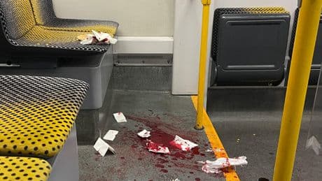 US-Bürger niedergestochen - Messerangriff in Dresdner Straßenbahn