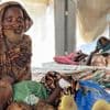 L'OMS a recensé plus de 400 000 cas de choléra dans le monde en 2025, le nombre de décès en hausse