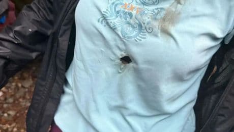 Tschechien: Deutsche Touristen beim Wandern von Blitz getroffen - Foto zeigt Loch im T-Shirt