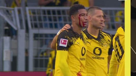 Guirassy genial! - Blut- und Wrestling-Sieg für Dortmund