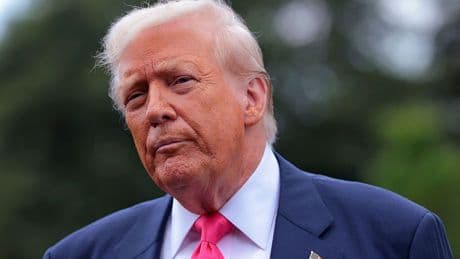 White House says Trump has a common circulatory condition