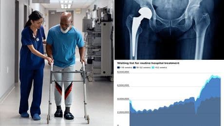 Health chiefs issue warning about NHS hip replacements: '1 in 100 chance of fracture'