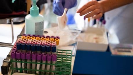 Breakthrough blood test detects cancer years before symptoms appear