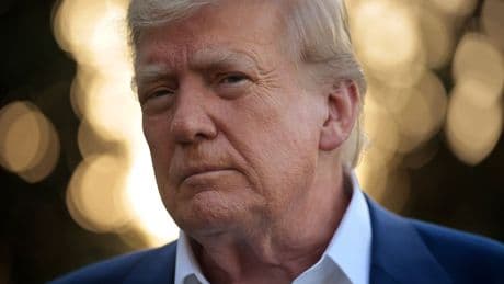 How alarming is Trump's vein condition? Here's what the White House said about his diagnosis