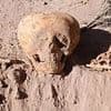Scientists are BAFFLED by a mysterious deformed skull discovered in Argentina - as some claim it could be so-called 'ANTMEN'