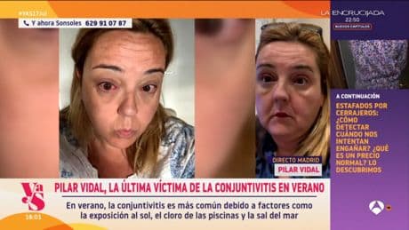 Pilar Vidal aparece en directo con los ojos muy irritados por conjuntivitis: &quot;Me los quiero arrancar&quot;