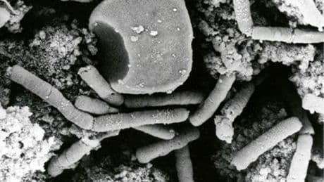 Thailand reports anthrax death as public health alert issued for outbreak