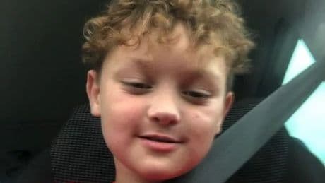 Boy, 8, undergoes facial reconstruction after dog attack 'left his lip hanging off'