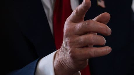 Donald Trump’s Assault on Capitalism