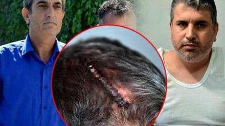 Miras yüzünden yeğenini beyzbol sopasıyla darbeden dayıdan şok sözler: Beni tahrik etti, dayanamadım