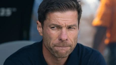 Real Madrid vor Saisonstart: Die kleinen und großen Probleme des Xabi Alonso