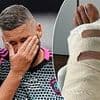 Tony Bellew admits 'pain is real' after surgery on gruesome Achilles injury suffered in Soccer Aid game - after saying it felt like he 'had been shot'