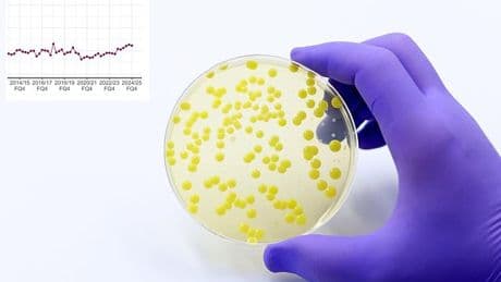 Brits warned against sharing towels and razors after spike in MRSA superbug infections outside of hospitals