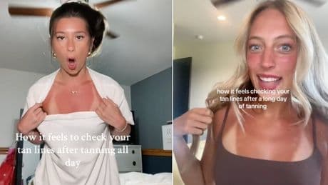 Abbronzatura selvaggia, il trend (pericoloso) virale sui social. L'esperta: «Rischio di sviluppare tumori»
