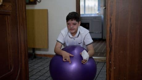 Survivors of Israel's pager attack on Hezbollah last year struggle to recover