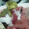 Drunk man impales EYE after falling face-first on to ornament - narrowly missing his brain