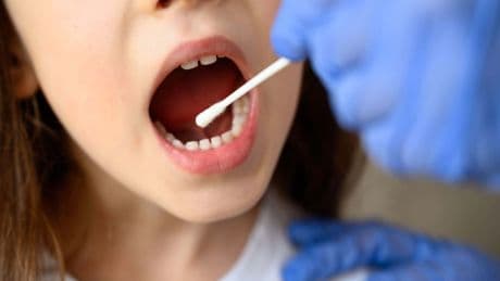 Simple cheek swab could help save lives of children with rare heart problem