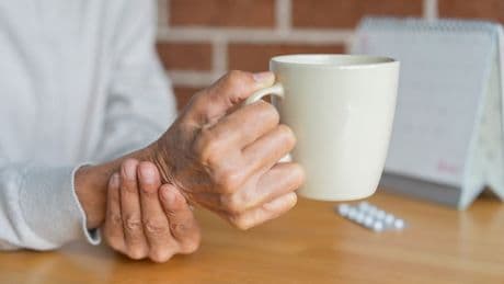 Parkinson'da yeni araştırma: Köpekler kokuyla tespit edebiliyor