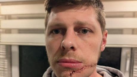 Musician scarred for life in horror slashing attack after masked stranger storms stage