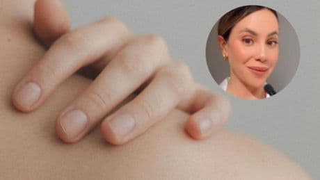 Esther Gómez, enfermera: ''Se estima que un 30% de la población mundial se muerde las uñas. A nivel físico, causa sangrado, infecciones y deformación de los dedos y dientes''