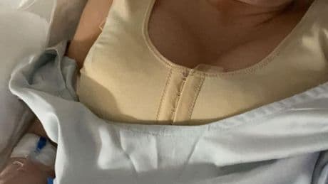I hated my massive 36J boobs that dangled ‘down to my stomach’ – but had to go abroad for risky op as no one would help