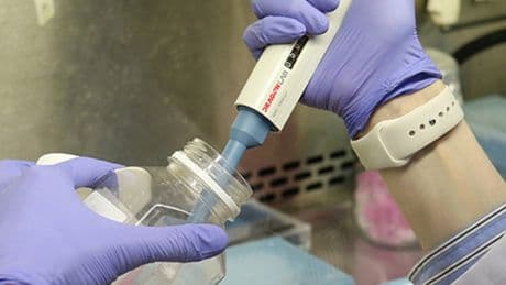 ALS hastalığında genetik temelli yeni tedavi stratejisi üzerinde çalışılıyor