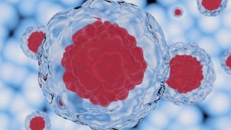 Gamechanger: Zelltherapien sollen gestörte Gehirnfunktionen bei Parkinson-Patienten lindern