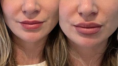 'Charlotte Tilbury's new double-ended lip liner makes my lips look like they have filler'
