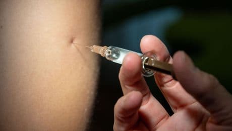 Infektionskrankheiten: Anstieg der Mpox-Infektionen in Berlin
