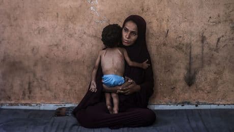 Trump says kids in Gaza are starving in break with Netanyahu