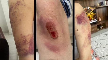 Aynı evde ev hapsi kararı bozuldu, şiddet faili tutuklandı