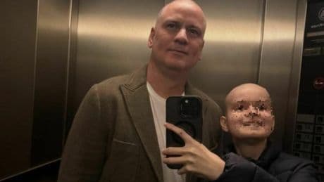Julio Sergio, morto il figlio Enzo: il 15enne era in coma, lottava da anni con un tumore al cervello