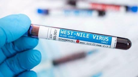 West NIle, casi (e morti) in crescita in Europa per il virus endemico in Africa: l'ondata del 2018 con 170 vittime