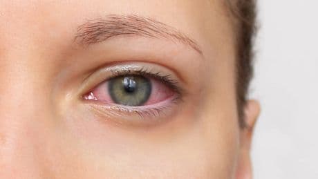 El síndrome silencioso más común en mujeres: seca los ojos, la boca y provoca cansancio