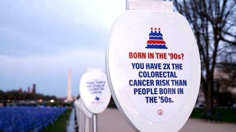 Major increase in colorectal cancer in younger adults tied to pandemic years, researchers say