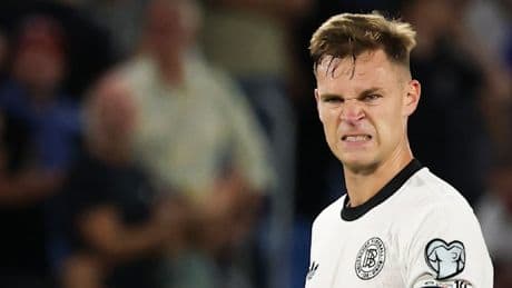 Jetzt gegen Nordirland – DFB-Team nach der Slowakei-Pleite schon unter Druck