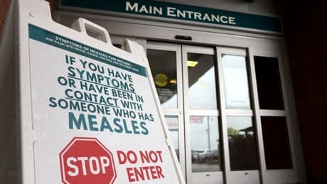 Measles exposure reported at B.C. prenatal clinic