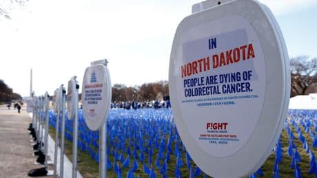 Colon cancer is spiking in young adults. Scientists are blaming the American diet