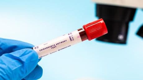 Chikungunya : les autorités redoutent l’importation de l’épidémie en métropole