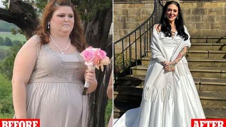 I lost nine stone on Mounjaro but then I was hit with this disfiguring side-effect I'd never heard of... and doctors say it's now on the rise
