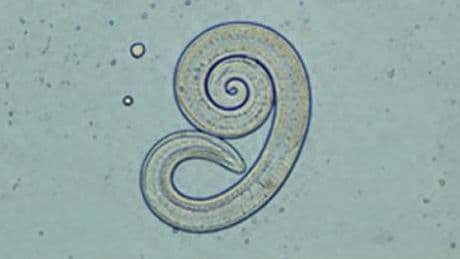 Ihr Körper als Wurm-Zuhause? So überleben winzigste Parasiten jahrelang unbemerkt